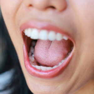 Los microbios en la boca podrían afectar al riesgo de deterioro cognitivo